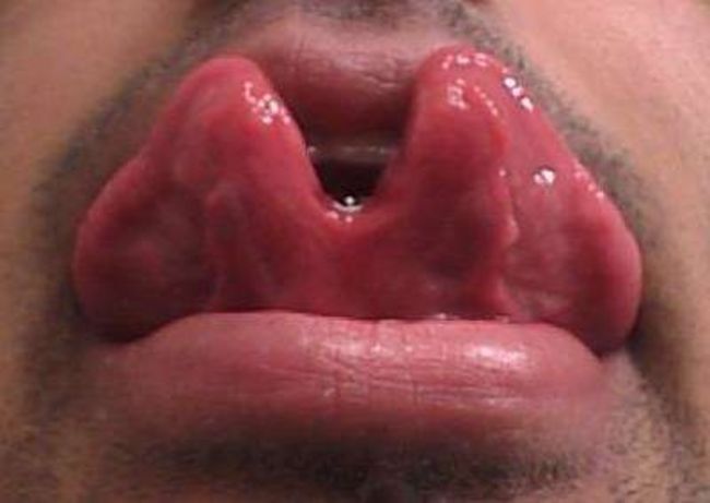 Poze Poze_MH - Tongue Piercing