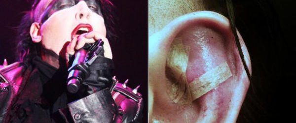 Marilyn Manson, incident violent in Elvetia (foto)